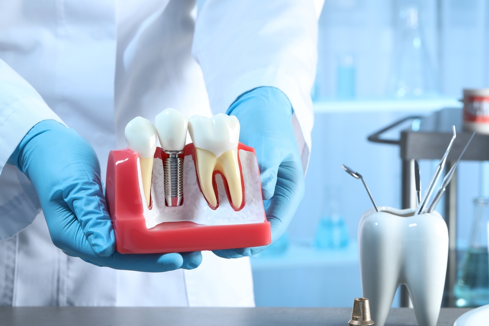 Find Dentist Offices That Take Your Insurance