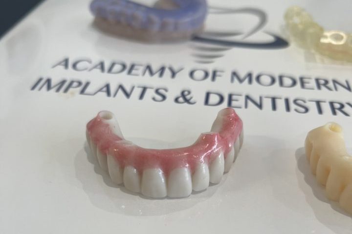 Temporary hybrid implant denture sitting on a manual showing the procedure of placing implant dentures