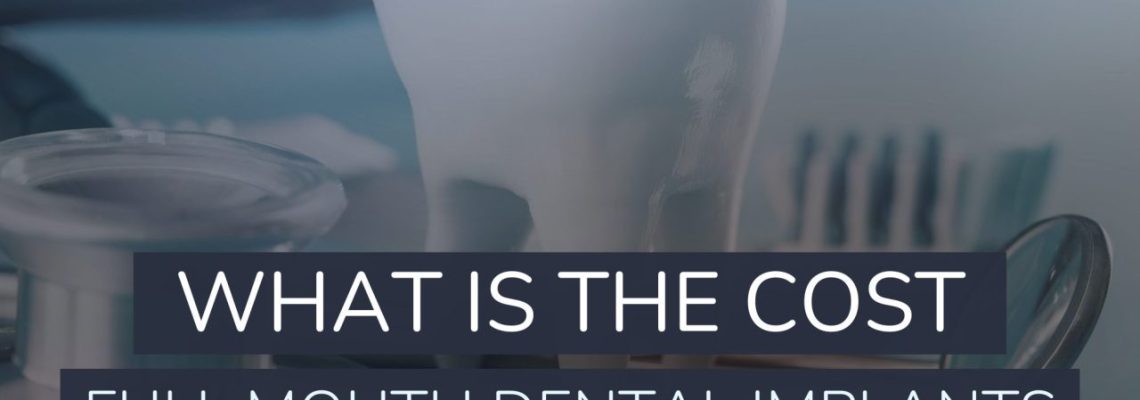 What Is The Cost Of Full Mouth Dental Implants?