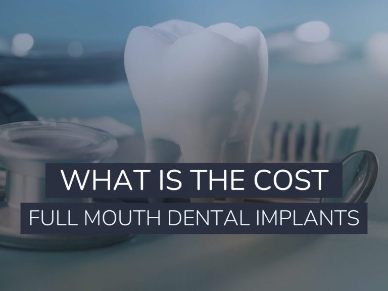 What Is The Cost Of Full Mouth Dental Implants?