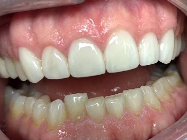 Real Patient Results — After