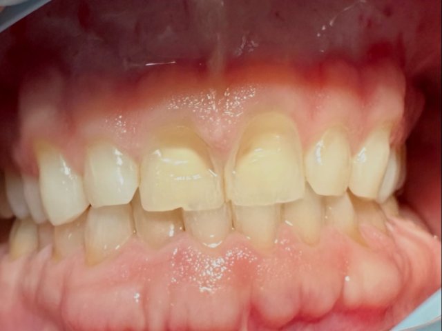 Real Patient Results — Before